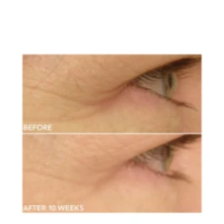 Dr Dennis Gross DRx SpectraLite EyeCare Max Pro -skin care shop DRx SpectraLite EyeCare Max Pro add11 55581 8703 general